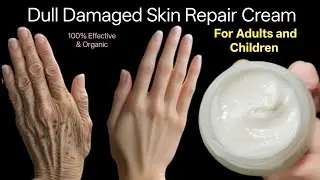 Winter Skin Repair Cream | Skin Care For Dry Skin | Easy Winter Skin Care Hacks |hand feet repair