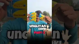 Superglue Vs Hand | Part-2 | #shorts