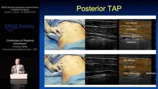 Challenges of Regional Analgesia - Enhanced Recovery after Surgery (ERAS®)