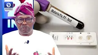 Nigeria To Start Local Manufacturing Of Malaria Test Kit - Health Minister