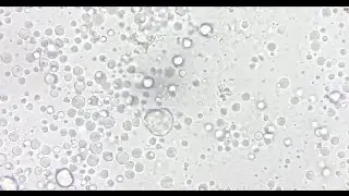 Under the Scope: Using Breast Milk to Observe Brownian Motion