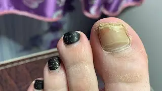 Педикюр себе чёрный красный