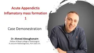 | GIT | Appendicitis | Acute appendicitis with inflammatory mass formation |