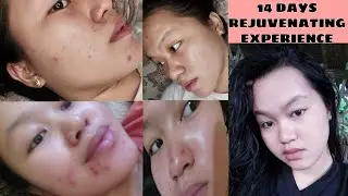 MY REJUVENATING EXPERIENCE (14 DAYS REVIEW) | SKIN LUXURIANT REJUV SET | PHILIPPINES