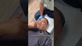 How To Avoid Deviated Septum Surgery ⚠️ [Help From Gonstead Chiropractor]