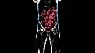 Abdominal scan