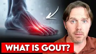High Uric Acid Foods To Avoid For Gout