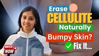 Cellulite Explained |  Causes, Hormonal Link & Natural Ways to Reduce It!