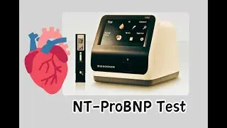 NT-ProBNP test || Cardiac Marker ||STANDARD™ F