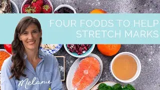 4 Foods to Help Stretch Marks
