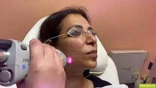 Laser Skin Tightening | Best Medspa BodyRx Louisville, KY