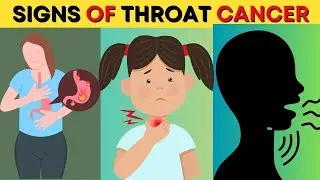 Throat Cancer Signs: 8 Warning Signs of Throat Cancer You Should NEVER Ignore