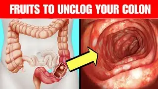 12 Amazing Fruits To Unclog Your Colon Fast