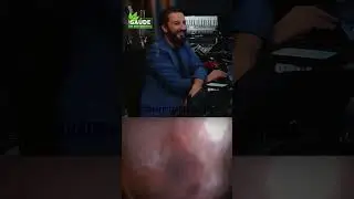 АЛОЭ ВЕРА с МЁДОМ и КАШАКОЙ! КАК ПРИГОТОВИТЬ?