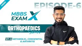 #MbbsExamX Orthopaedics Series (Ep 6) 🦴🎯 Hinglish University Exam Preparation Guide