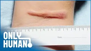 Bugs, Bites & Parasites: Tropical Diseases Uncovered | Only Human