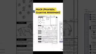 MOCA (Монреальская когнитивная оценка): полезность при деменции #паллиативнаяпомощь
