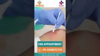 ACL Surgery Complications | You Must Need To Know | Dr. Rakesh Kumar