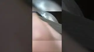 Pommel
