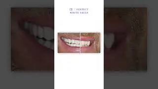 Perfect White Smile is here to help you create the smile of your dreams 💭 Book now!