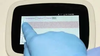 Truenat Video 8 - Reading the Results of Truenat MTB & MTB- RIF