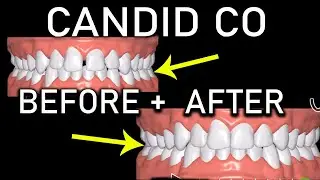Candid Co BEFORE and AFTER Complete Review 2021 with working Discount Code!