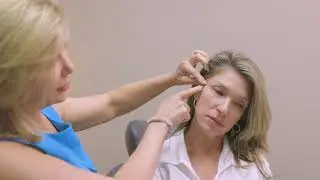PDO Thread Lift Experience