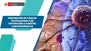 PREVENCION DE CANCER OCUPACIONAL POR EXPOSICION A AGENTES CARCINOGENICOS
