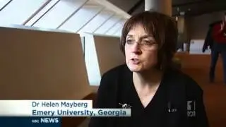 Mental health breakthroughs impress experts
