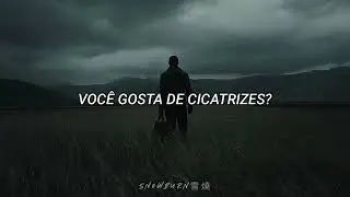Michael Malarkey - Scars (Tradu&ccedil;&atilde;o/Legendado)