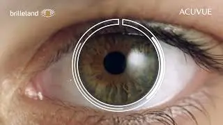 Kontaktlinser Brilleland - Acuvue Moisture Astigmatisme/skjeve hornhinner