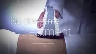 VelaShape III: Cellulite Reduction in Orlando