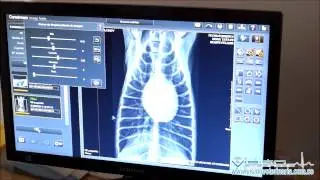 Digitalizador Veterinario Carestream Vita CR