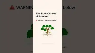 The Root Causes of Eczema⁣
