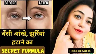 7 Days to Get Rid of SUNKEN EYES and Wrinkles at Home