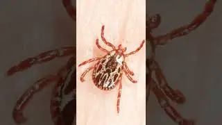 American Dog Tick (Dermacentor variabilis) in Hardbacked Tick Family (Ixodidae)