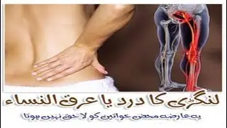 Sciatica Causes, Symptoms, Treatment, Prevention & Pain | Types of Sciatic Nerve Pain - Spine-Health