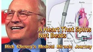 Dick Cheney&rsquo;s Bionic Heart: A Journey Through Modern Medicine