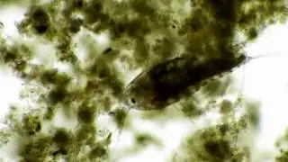 Oczlik (Cyclops sp.) pod mikroskopem.