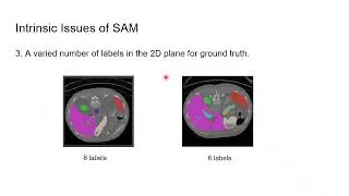 [ICCV 2025] MaskSAM: Towards Auto-prompt SAM with Mask Classification for Medical Image Segmentation