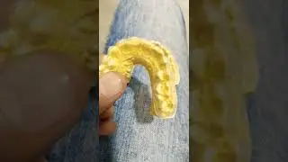 Upper and Lower Aligner Making By Haider #aligner #retainer #dentalartbyhaider