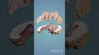 Anatom&iacute;a del cerebro en 3D - Neuroanatom&iacute;a en 3D con VOKA