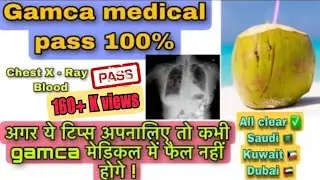Gamca medical Chest x-ray Pass | Tips for medical fit | क्या नारियल पानी पीने से XRay fit होजयगा.