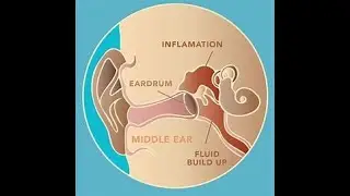 Understanding Common Ear Diseases