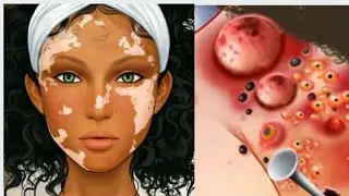 cover up white spots on the face #asmr #animukbang #asmrfood #makeup #asmrsounds #makeuptutorial #팅글