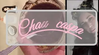 Dile adi&oacute;s a la caspa 