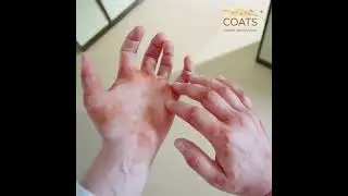 Protect & Soothe With Every Wear | COATS&reg; Colloidal Oatmeal System