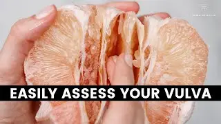 Vulvar Self Assessment Made Easy | Live With Dr. Laura