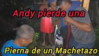 Andy pierde una pierna de un machetazo#quechilero#lucilaylossinar#viral#chapin
