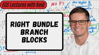 Right Bundle Branch Blocks | Day 9 ECG Challenge